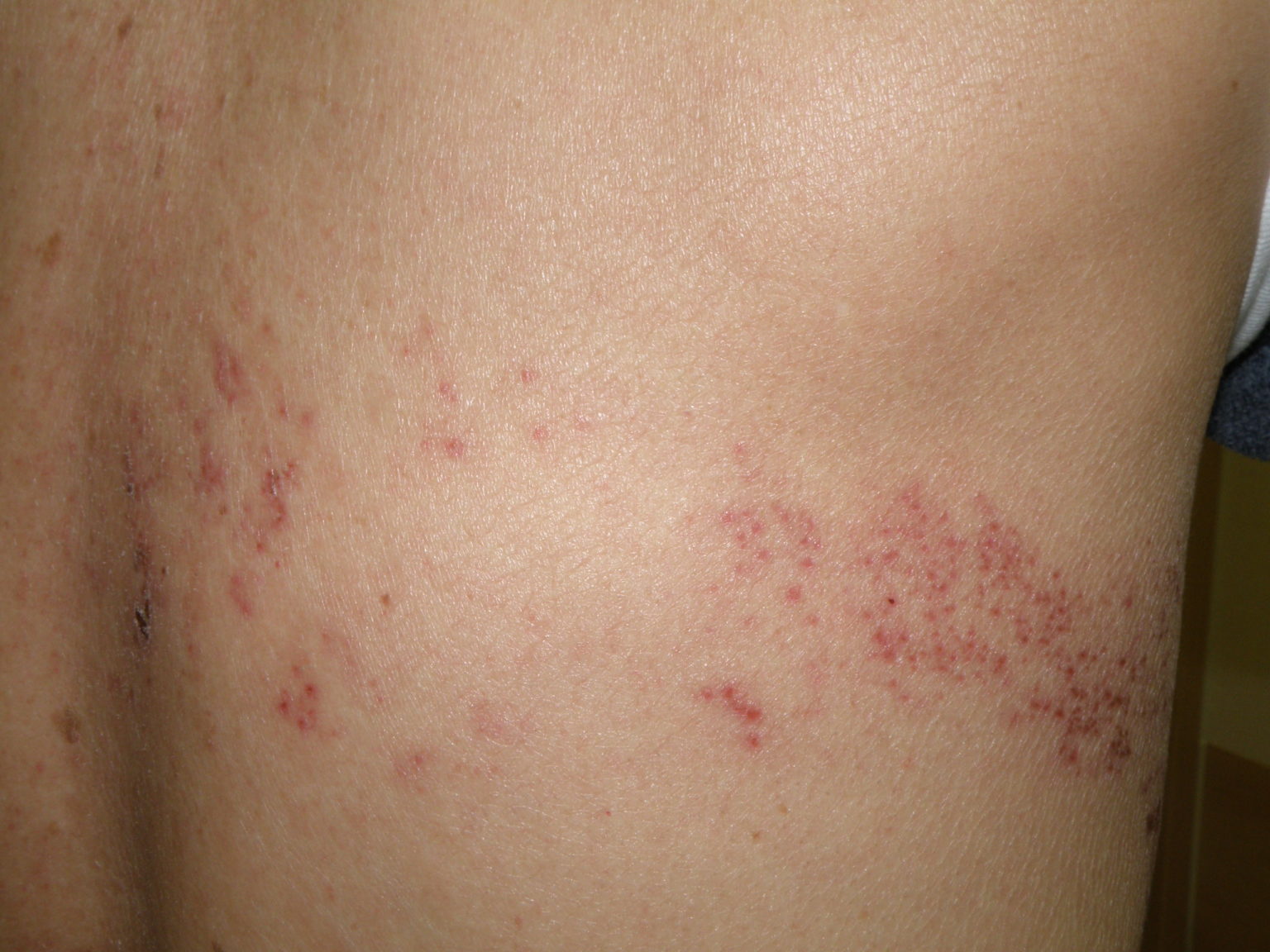 いつ医師に連絡すべきでしょうか?