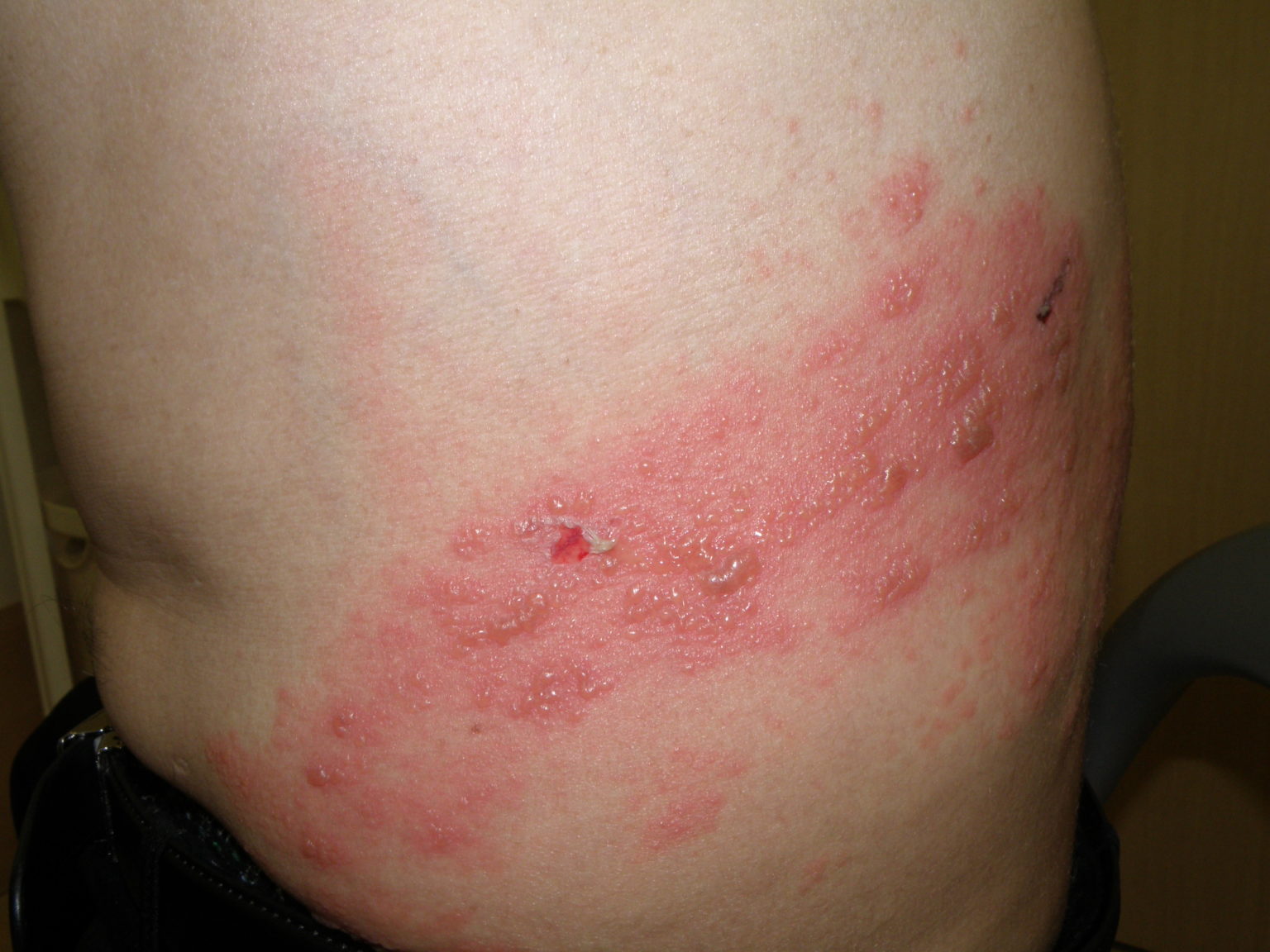 同様の症状を引き起こす症状